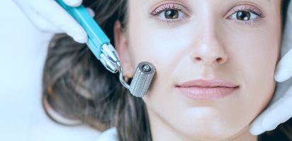 Microneedling München